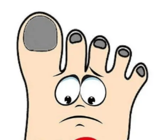 图片[2]-灰指甲长什么样？让你的手脚健康又美丽！-人生海web技术分享