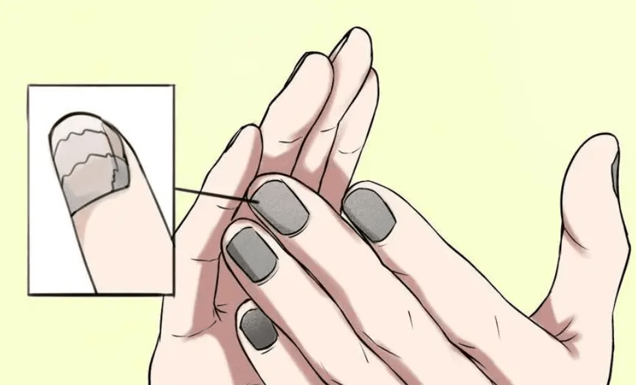 图片[2]-灰指甲康复者手把手教你 如何在家就能轻松搞定指甲发黄增厚！-人生海web技术分享